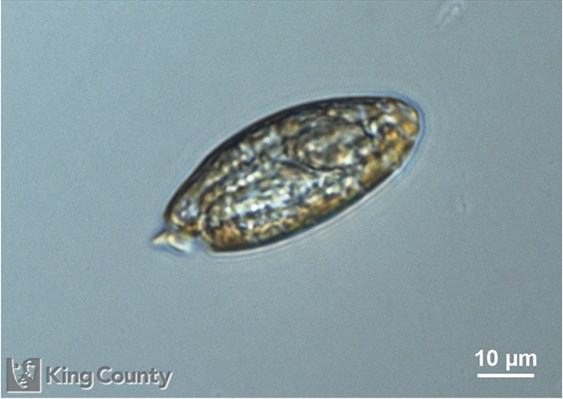 Photo of Torodinium cf. robustum